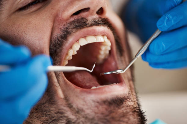 Best Teeth Whitening  in Johnsonburg, PA